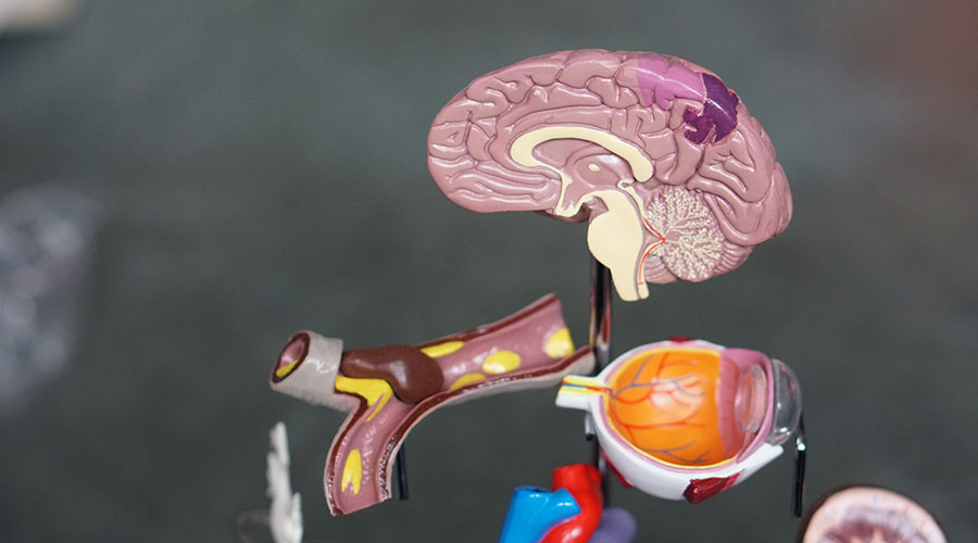 brain organ model